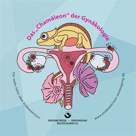endometriose vereinigung deutschland e.v